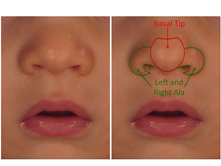 diagrama de la nariz de un niño
