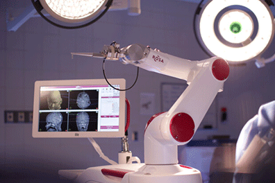 Rosa™ - Robotic Surgery - Neurosurgery Children's Health